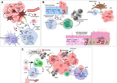 Inflammasomes in Cancer Progression and Anti-Tumor Immunity